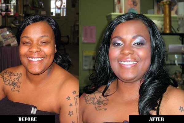 Before and After