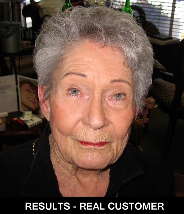 Miracle Eyes Results