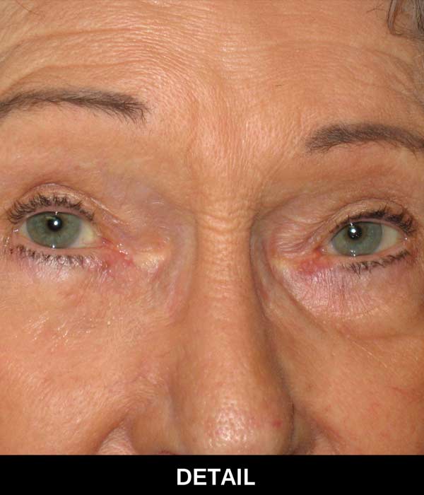 Miracle Eyes Details