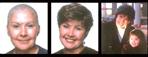 Woman - Cancer survivor